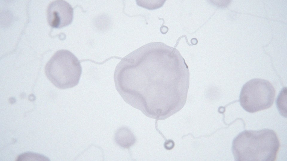 Jakie są funkcje dehydrogenazy mleczanowej w organizmie?